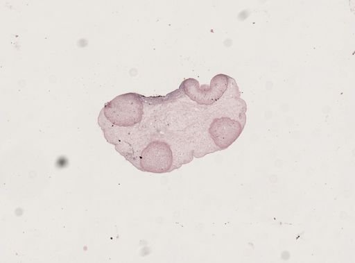 Taenia solium