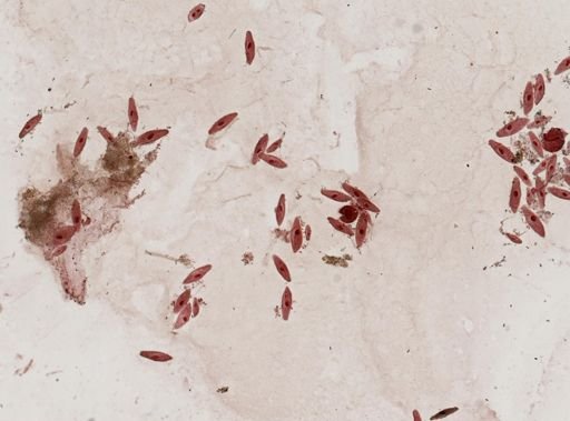Paramecium