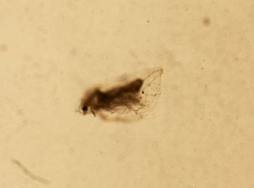 Daphnia pulex
