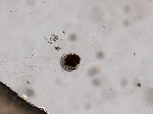 Euchlanis triquetra