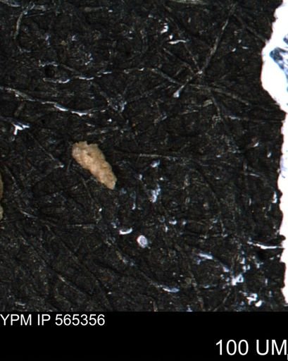 Verneuilina canadensis