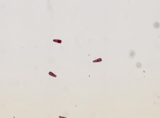 Fasciola hepatica