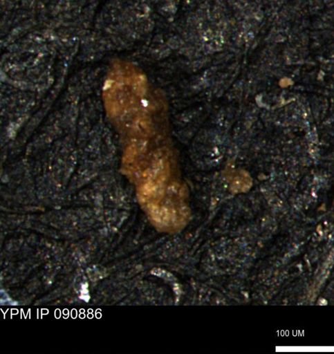 Verneuilina canadensis