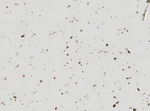 Diplodium