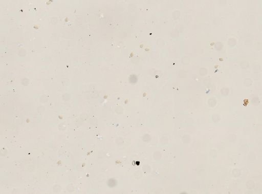 Clonorchis sinensis