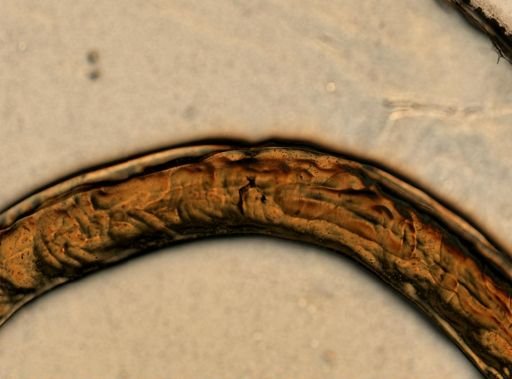 Ancylostoma caninum