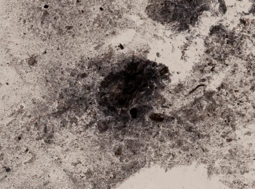 Entamoeba coli