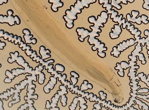 Ancylostoma duodenale