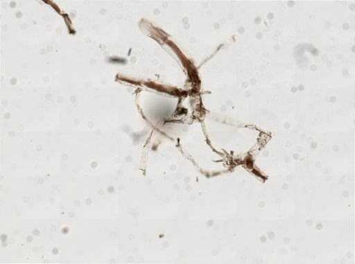 Victorella pavida