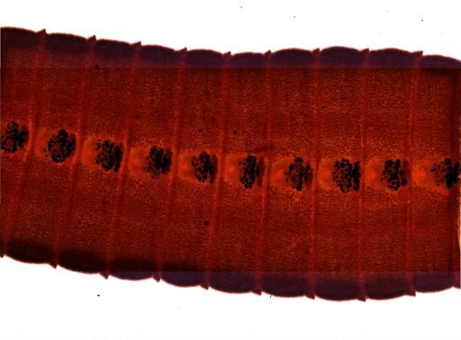 Diphyllobothrium erinacei