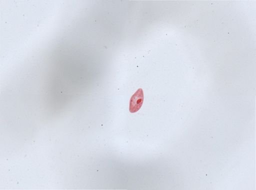 Paramecium aurelia