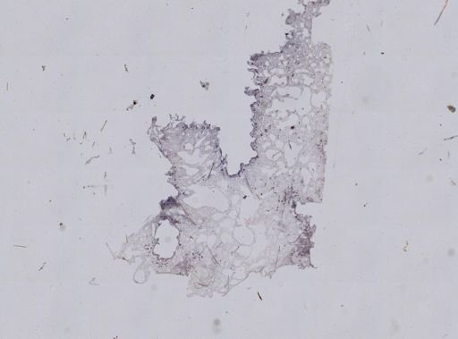 Hispidopetra miniana