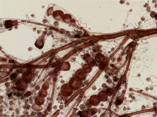 Gonothyraea