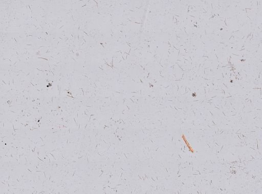 Callyspongia vaginalis