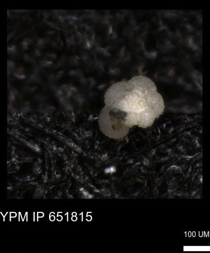 undet. Rugoglobigerinidae