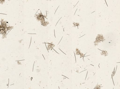 Spongilla fragilis