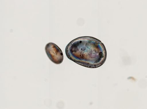 Ostracoda