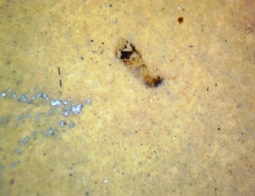 undet. Hexapoda