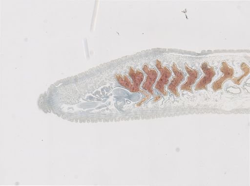 Glossiphonia?
