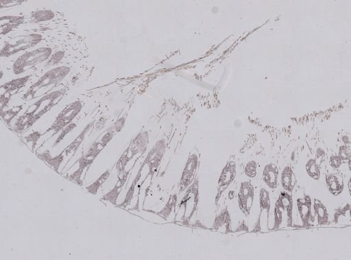 Ceratoporella nicholsoni