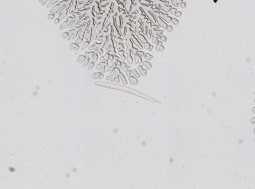 Necator americanus