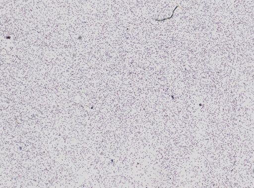 Plasmodium lophurae