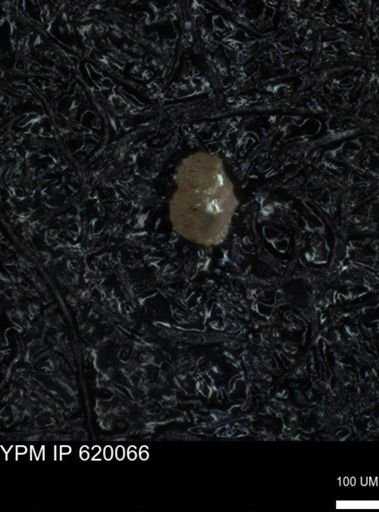 undet. Foraminiferida