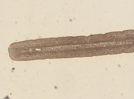 Taenia taeniaeformis