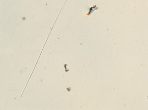 Licnophora?