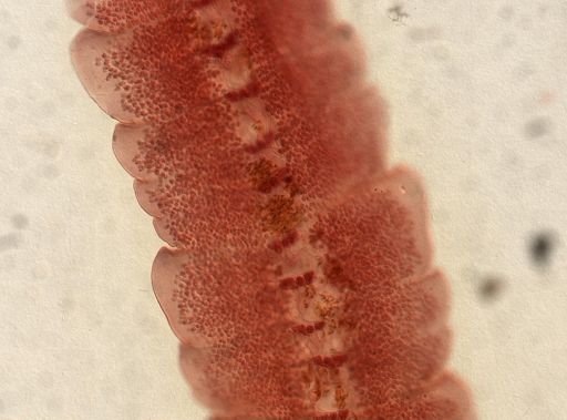 Eucestoda