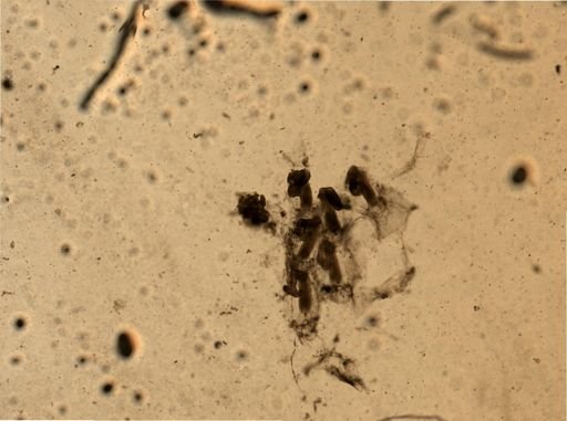 Bryozoa