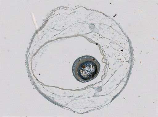 Plotonemertes adhaerens
