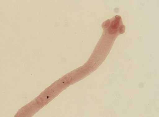 Dipylidium caninum
