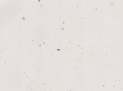 Paramecium