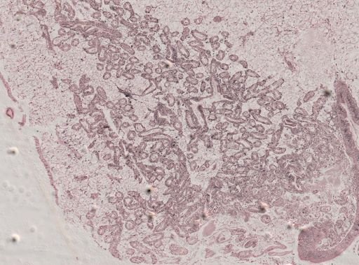 Modiolus