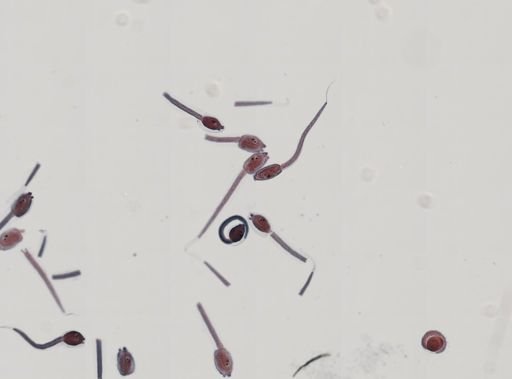 Tunicata