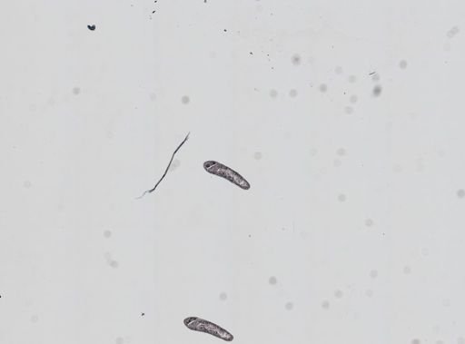 Plagiostomum whitmani