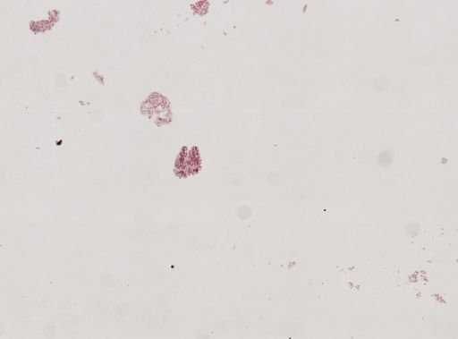Fasciola hepatica