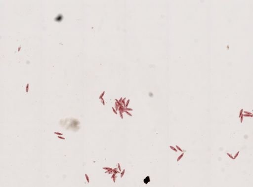 Paramecium