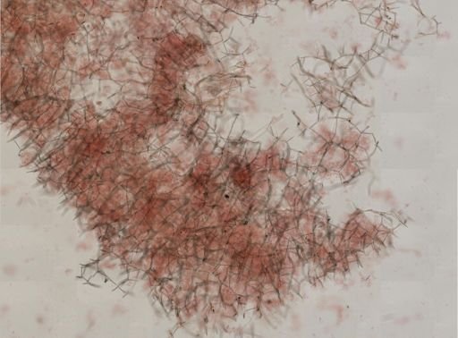 Haliclona oculata