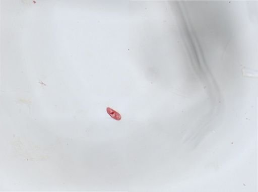 Paramecium