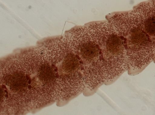 Eucestoda