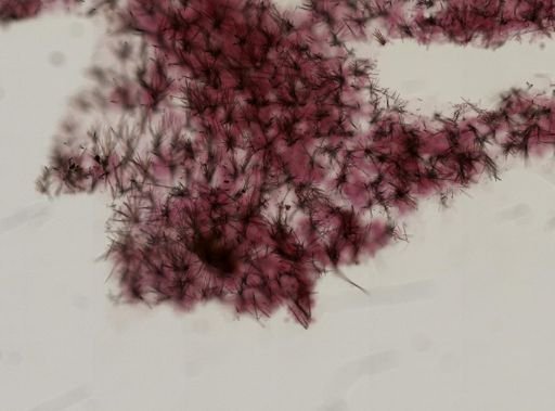 Hymedesmia sp.
