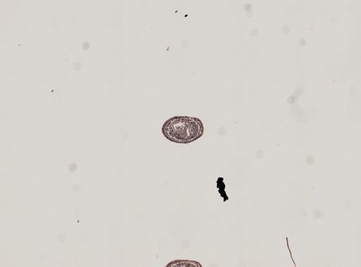 Plagiostomum whitmani
