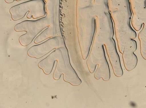 Haemonchus contortus
