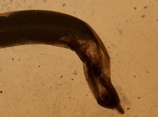 Enterobius vermicularis