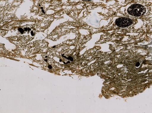 Ircinia sp.