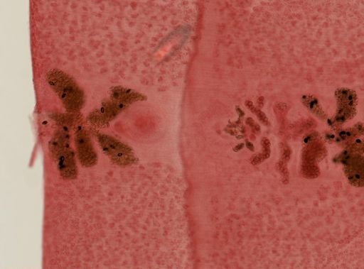 Diphyllobothrium latum