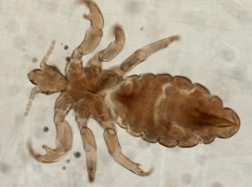 Pediculus humanus