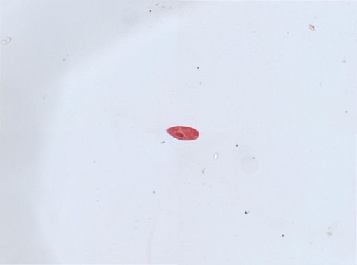Paramecium aurelia